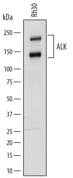 Invitrogen ALK Polyclonal Antibody 100 &mu;g; Unconjugated:Antibodies,