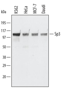 Invitrogen SP3 Polyclonal Antibody 100 &mu;g | Buy Online | Invitrogen&trade; | Fisher Scientific