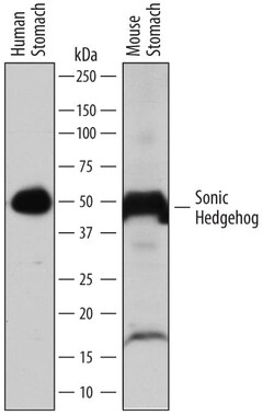 Invitrogen SHH Polyclonal Antibody 100 &mu;g; Unconjugated:Antibodies,