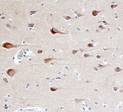 Invitrogen beta-Arrestin 2 Polyclonal Antibody 100 &mu;g; Unconjugated:Antibodies,