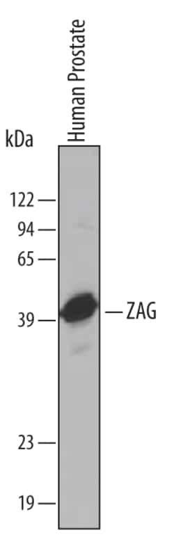 Invitrogen AZGP1 Polyclonal Antibody 100 &mu;g; Unconjugated:Antibodies,