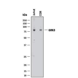 Invitrogen GRK3 Polyclonal Antibody 100 &mu;g | Buy Online | Invitrogen&trade; | Fisher Scientific