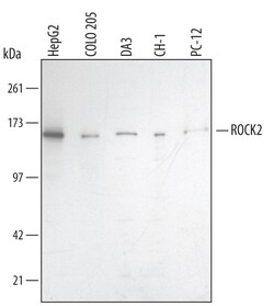 Invitrogen ROCK2 Polyclonal Antibody 100 &mu;g; Unconjugated:Antibodies,
