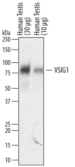 Invitrogen VSIG1 Polyclonal Antibody 100 &mu;g; Unconjugated:Antikörper
