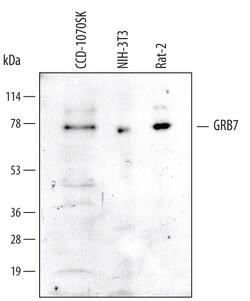 Invitrogen GRB7 Polyclonal Antibody 100 &mu;g; Unconjugated:Antibodies,