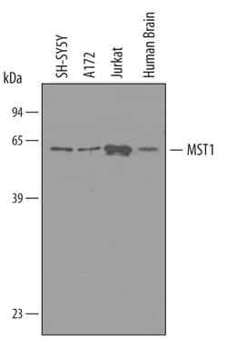 Invitrogen MST1 (STK4) Polyclonal Antibody 100 &mu;g | Buy Online | Invitrogen&trade; | Fisher Scientific
