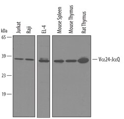 Invitrogen TCR V alpha 24 J alpha 18 Polyclonal Antibody 100 &mu;g; Unconjugated:Antibodies,