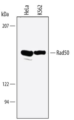 Invitrogen RAD50 Polyclonal Antibody 100 &mu;g; Unconjugated:Antibodies,