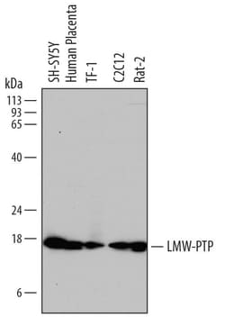 Invitrogen Acid Phosphatase 1 Polyclonal Antibody 100 &mu;g; Unconjugated:Antibodies,