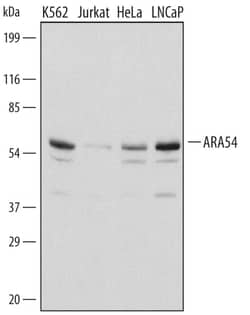 Invitrogen RNF14 Polyclonal Antibody 100 &mu;g; Unconjugated:Antibodies,