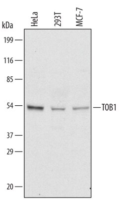 Invitrogen TOB1 Polyclonal Antibody 100 &mu;g; Unconjugated:Antibodies,
