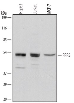 Invitrogen PRR5 Polyclonal Antibody 100 &mu;g; Unconjugated:Antibodies,