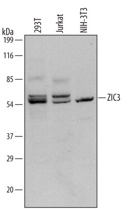 Invitrogen ZIC3 Polyclonal Antibody 100 &mu;g; Unconjugated:Antibodies,