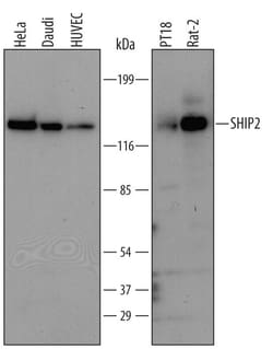 Invitrogen SHIP2 Polyclonal Antibody 100 &mu;g; Unconjugated:Antibodies,
