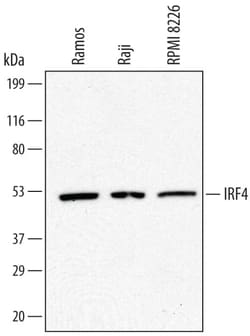 Invitrogen IRF4 Polyclonal Antibody 100 &mu;g; Unconjugated:Antibodies,