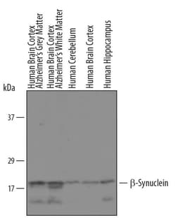 Invitrogen beta Synuclein Polyclonal Antibody 100 &mu;g; Unconjugated:Antibodies,