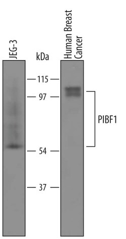 Invitrogen PIBF1 Polyclonal Antibody 100 &mu;g; Unconjugated:Antikörper