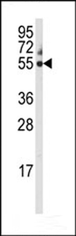 Invitrogen CYP3A5 Polyclonal Antibody 400 &mu;L; Unconjugated:Antibodies,