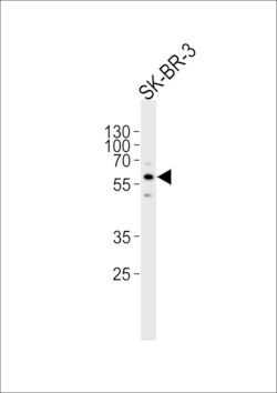 Invitrogen CYP3A5 Polyclonal Antibody 400 &mu;L; Unconjugated:Antibodies,