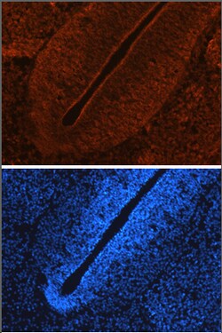 Invitrogen LRRTM2 Polyclonal Antibody 100 &mu;g; Unconjugated:Antibodies,