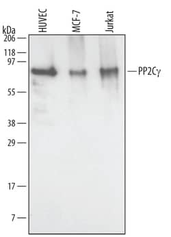 Invitrogen PPM1G Polyclonal Antibody 100 &mu;g; Unconjugated:Antibodies,