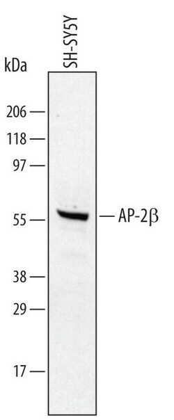 Invitrogen AP2 beta Polyclonal Antibody 100 &mu;g; Unconjugated:Antibodies,