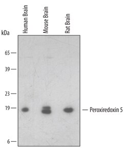 Invitrogen PRDX5 Polyclonal Antibody 100 &mu;g; Unconjugated:Antibodies,