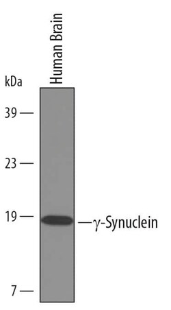 Invitrogen gamma Synuclein Polyclonal Antibody 100 &mu;g; Unconjugated:Antikörper