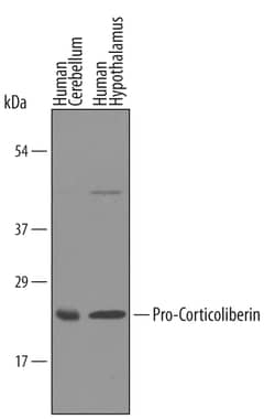 Invitrogen pro-CRF Polyclonal Antibody 100 &mu;g; Unconjugated:Antibodies,