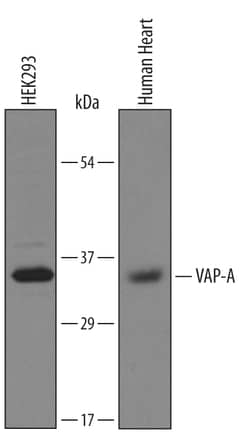 Invitrogen VAPA Polyclonal Antibody 100 &mu;g; Unconjugated:Antibodies,