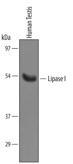 Invitrogen LIPI Polyclonal Antibody 100 &mu;g; Unconjugated:Antibodies,