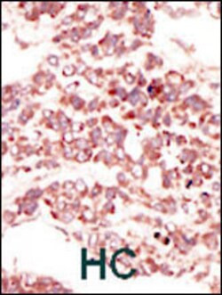 Invitrogen PTK7 Polyclonal Antibody 400 &mu;L; Unconjugated:Antibodies,