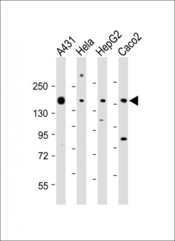 Invitrogen PTK7 Polyclonal Antibody 400 &mu;L; Unconjugated:Antibodies,