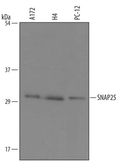 Invitrogen SNAP25 Polyclonal Antibody 100 &mu;g; Unconjugated:Antibodies,