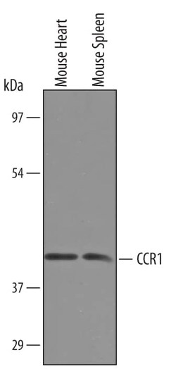 Invitrogen CCR1 Polyclonal Antibody 100 &mu;g; Unconjugated:Antibodies,