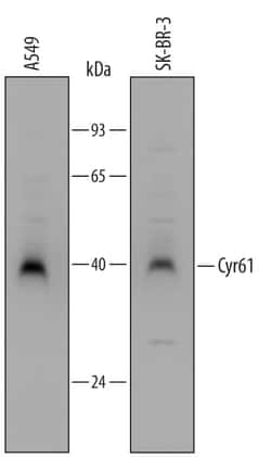 Invitrogen CYR61 Polyclonal Antibody 100 &mu;g; Unconjugated:Antibodies
