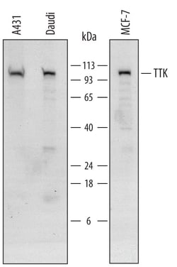 Invitrogen TTK Polyclonal Antibody 100 &mu;g; Unconjugated:Antibodies,