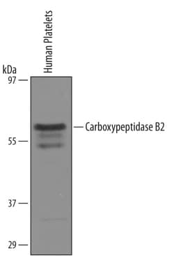 Invitrogen Carboxypeptidase B2 Polyclonal Antibody 100 &mu;g; Unconjugated:Antikörper