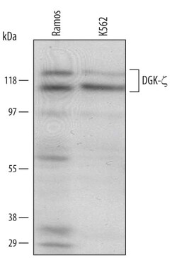 Invitrogen DGKZ Polyclonal Antibody 100 &mu;g; Unconjugated:Antikörper