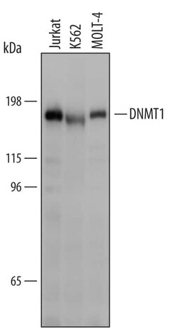 Invitrogen DNMT1 Polyclonal Antibody 100 &mu;g; Unconjugated:Antibodies,