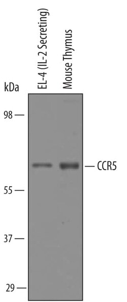 Invitrogen CCR5 Polyclonal Antibody 100 &mu;g; Unconjugated:Antikörper