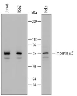 Invitrogen KPNA1 Polyclonal Antibody 100 &mu;g; Unconjugated:Antibodies,