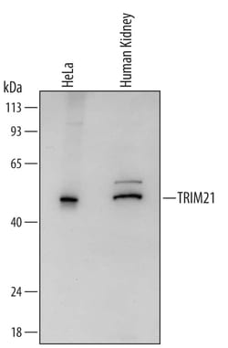Invitrogen TRIM21 Polyclonal Antibody 100 &mu;g; Unconjugated:Antibodies,