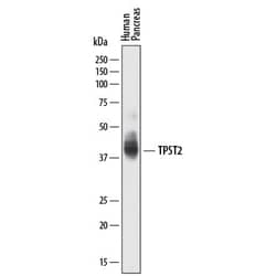 Invitrogen TPST2 Polyclonal Antibody 100 &mu;g; Unconjugated:Antibodies,