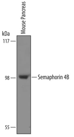 Invitrogen SEMA4B Polyclonal Antibody 100 &mu;g; Unconjugated:Antibodies,