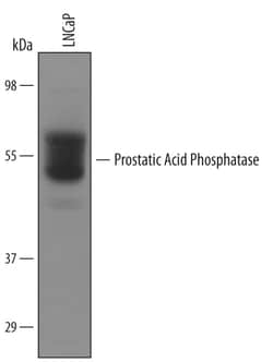 Invitrogen Prostate Specific Acid Phosphatase Polyclonal Antibody 100 &mu;g;