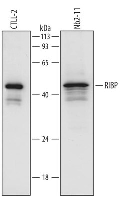 Invitrogen SH2D2A Polyclonal Antibody 100 &mu;g; Unconjugated:Antibodies,