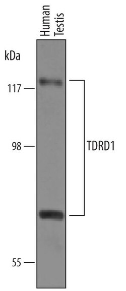 Invitrogen TDRD1 Polyclonal Antibody 100 &mu;g; Unconjugated:Antibodies,