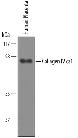 Invitrogen COL4A1 Polyclonal Antibody 100 &mu;g; Unconjugated:Antibodies,