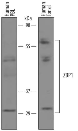 Invitrogen ZBP1 Polyclonal Antibody 100 &mu;g; Unconjugated:Antibodies,